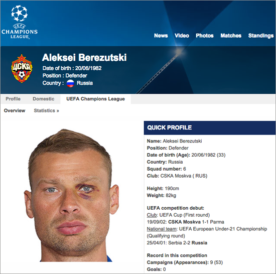 Алексей Березуцкий, синяк, сайт uefa